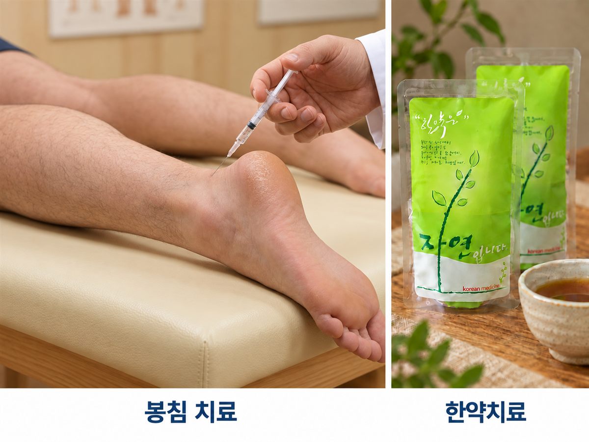 아킬레스건염의 치료