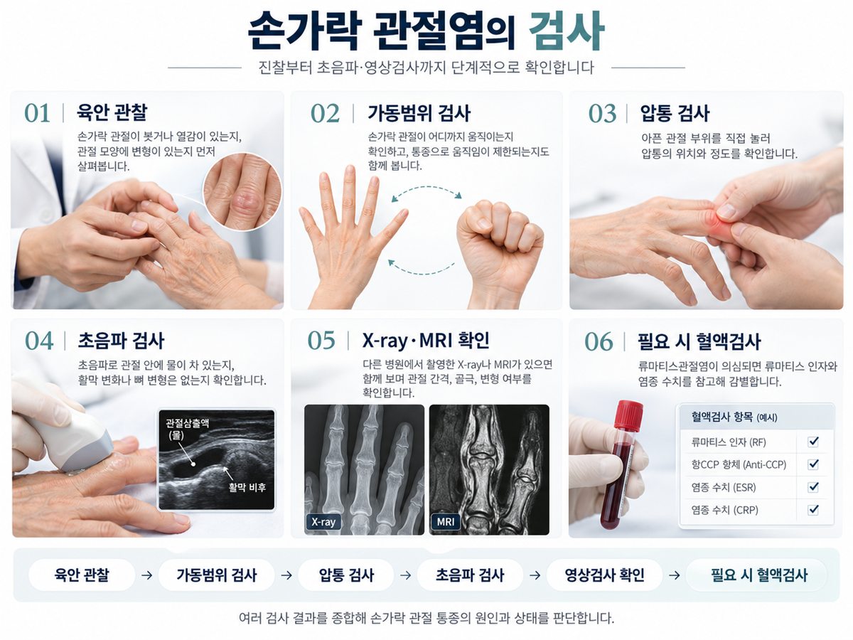 손가락 관절염의 검사 — 육안 관찰, 가동범위 검사, 압통 검사, 초음파 검사, X-ray·MRI 확인, 필요 시 혈액검사의 여섯 단계를 그림으로 정리