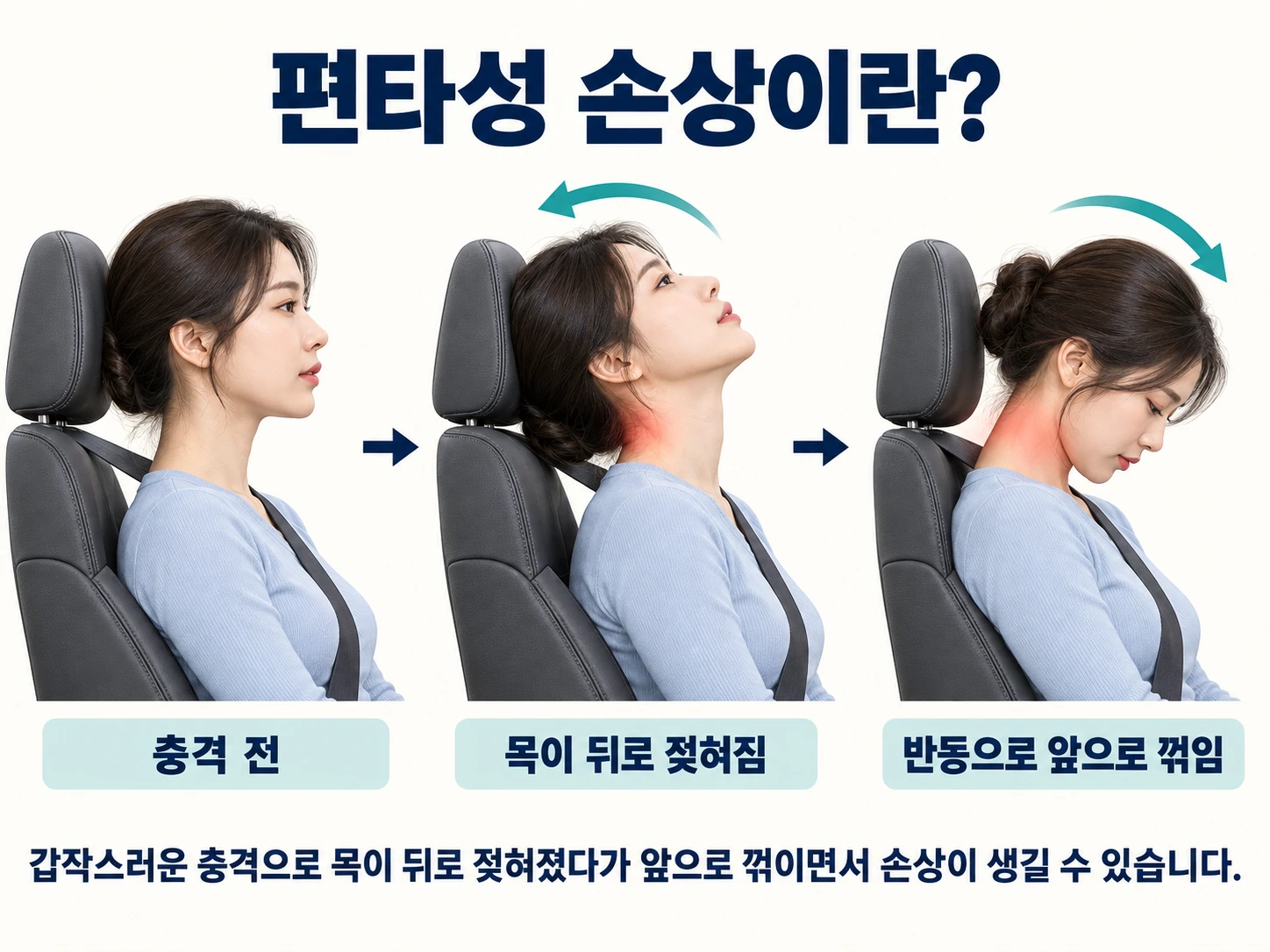 편타성 손상이란? — 충격 전, 목이 뒤로 젖혀짐, 반동으로 앞으로 꺾임. 갑작스러운 충격으로 목이 뒤로 젖혀졌다가 앞으로 꺾이면서 손상이 생길 수 있습니다