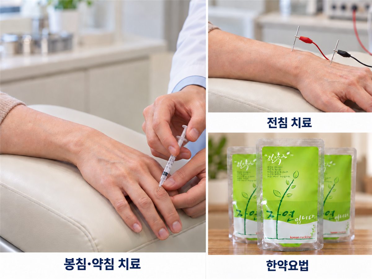 봉침·약침 치료, 전침 치료, 한약요법