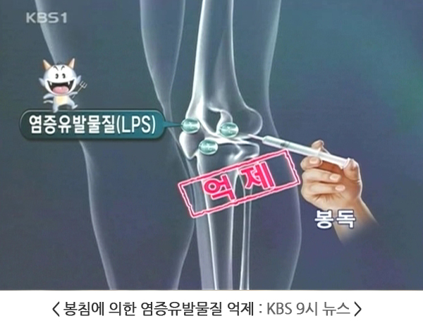 뉴스 화면 — 무릎관절 그림에 염증유발물질(LPS)이 붙어 있고, 봉독 주사가 이를 억제한다는 표시