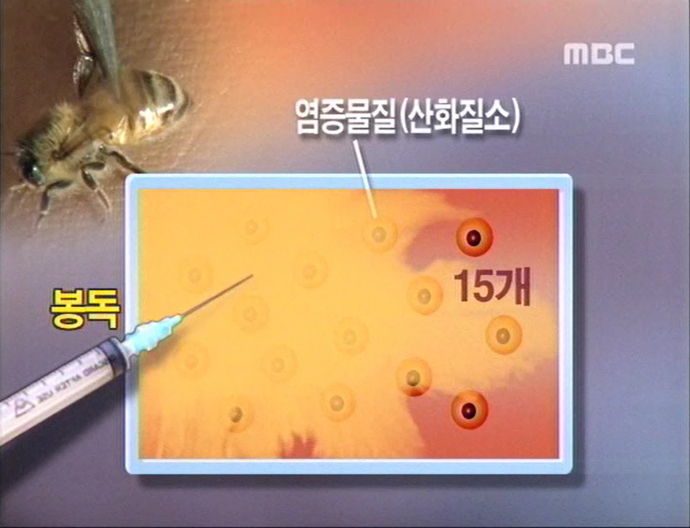 MBC 방송 화면 — 봉독에 의해 산화질소 감소