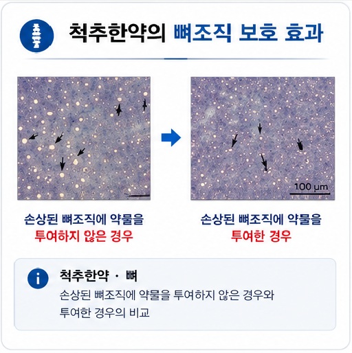 척추한약은 뼈 조직을 보호하는 효과가 있습니다.