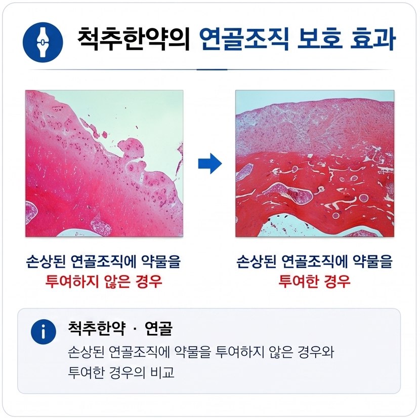 척추한약은 연골조직을 보호하는 효과가 있습니다.