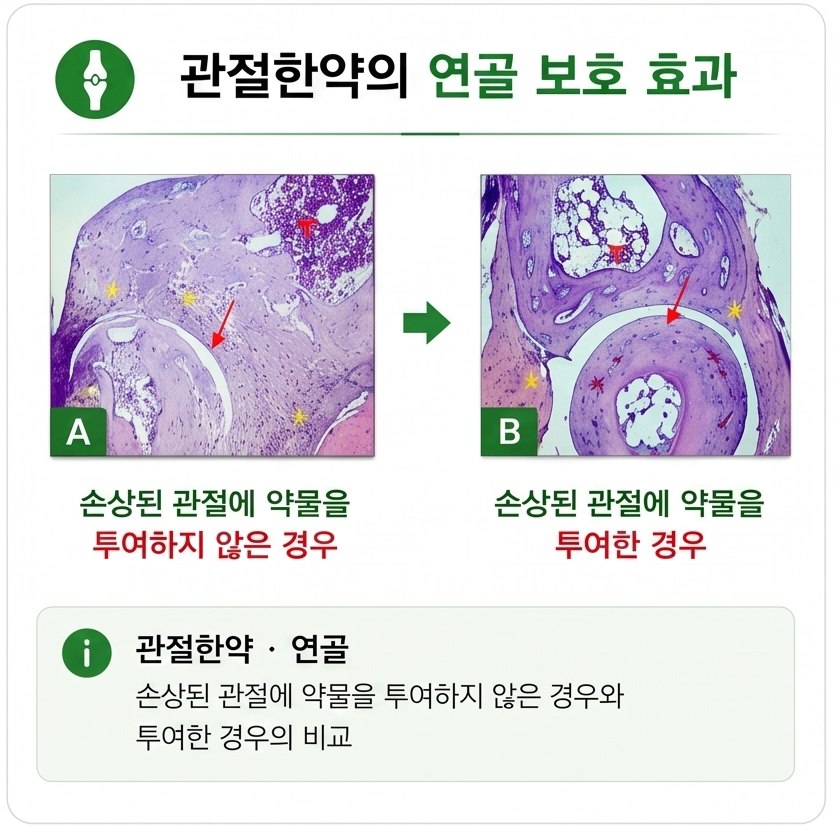 관절한약은 연골을 보호하는 효과가 있습니다.