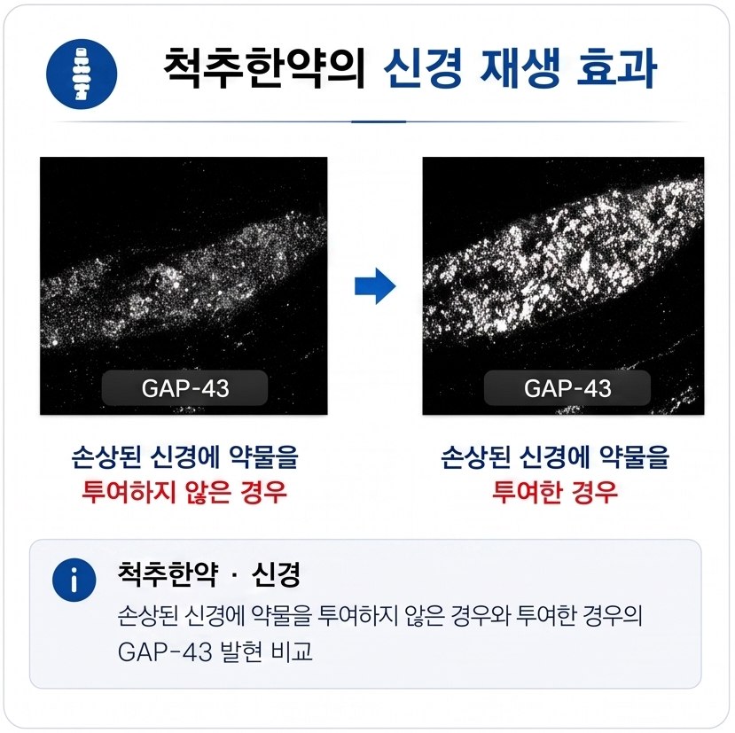척추한약은 신경을 재생시키는 효과가 있습니다.