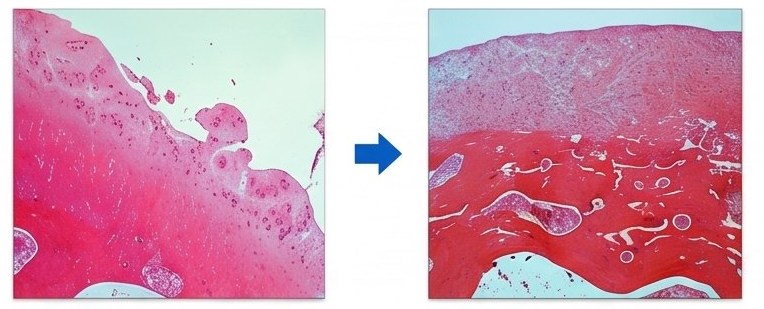 척추한약 — 손상된 연골조직에 약물을 투여하지 않은 경우와 투여한 경우의 비교 현미경 사진
